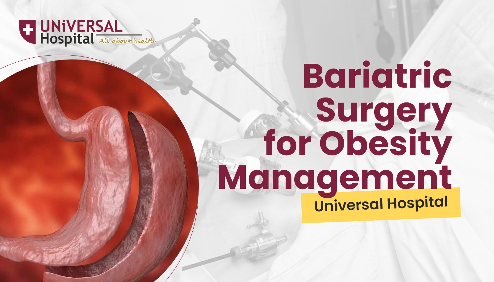 Bariatric Surgery for Obesity Management